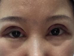 -坤如玛丽·医疗美容中心