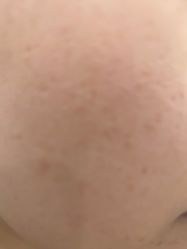 -美瑞莎创美医疗美容
