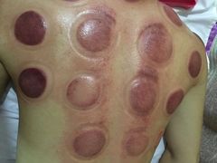 -益友堂盲人推拿正骨穴位按摩工作室