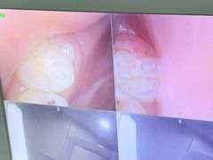 -土豆口腔(凤凰北总店)