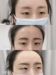 点击看大图 -久匠·野生眉半永久纹眉