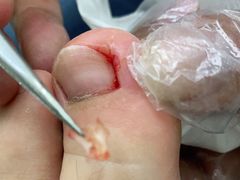 -新甲连锁灰指甲·甲沟炎·鸡眼(黑龙江路店)