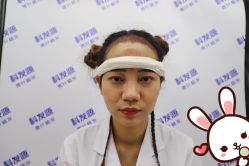 -大麦微针植发丨全国连锁