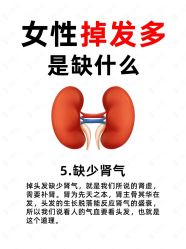 -克丽缇娜