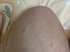 -复旦大学附属华山医院(总院)