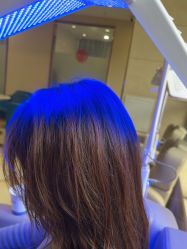 -碧莲盛·不剃发植发