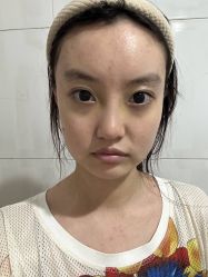 -成都西区医院整形美容