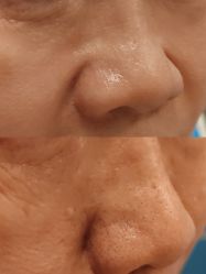 点击看大图 -王妃SPA·美容·科技抗衰
