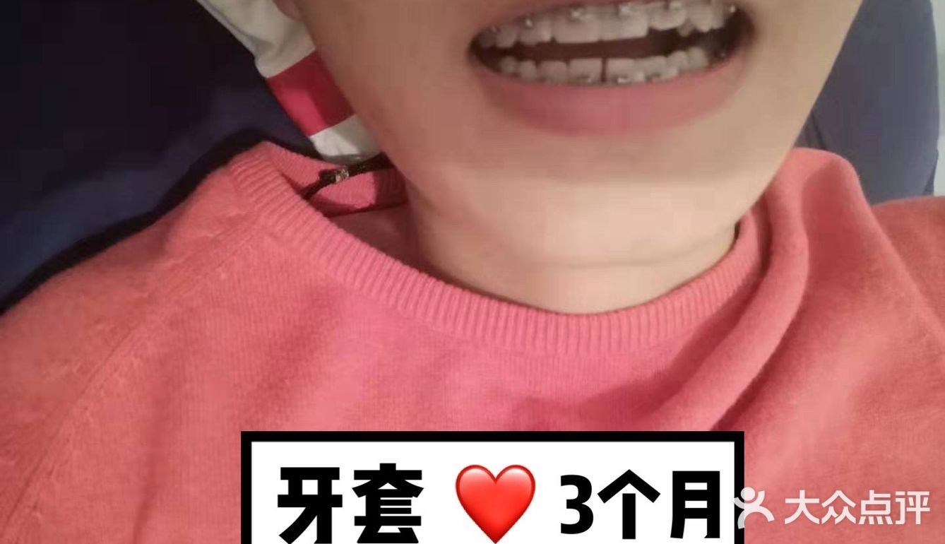 【案例分享】今天我们来讲个小帅哥的正畸案例