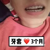 【案例分享】今天我们来讲个小帅哥的正畸案例