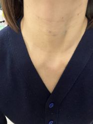 体验前-上海首尔丽格医疗美容医院