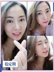 -广东韩妃整形外科医院