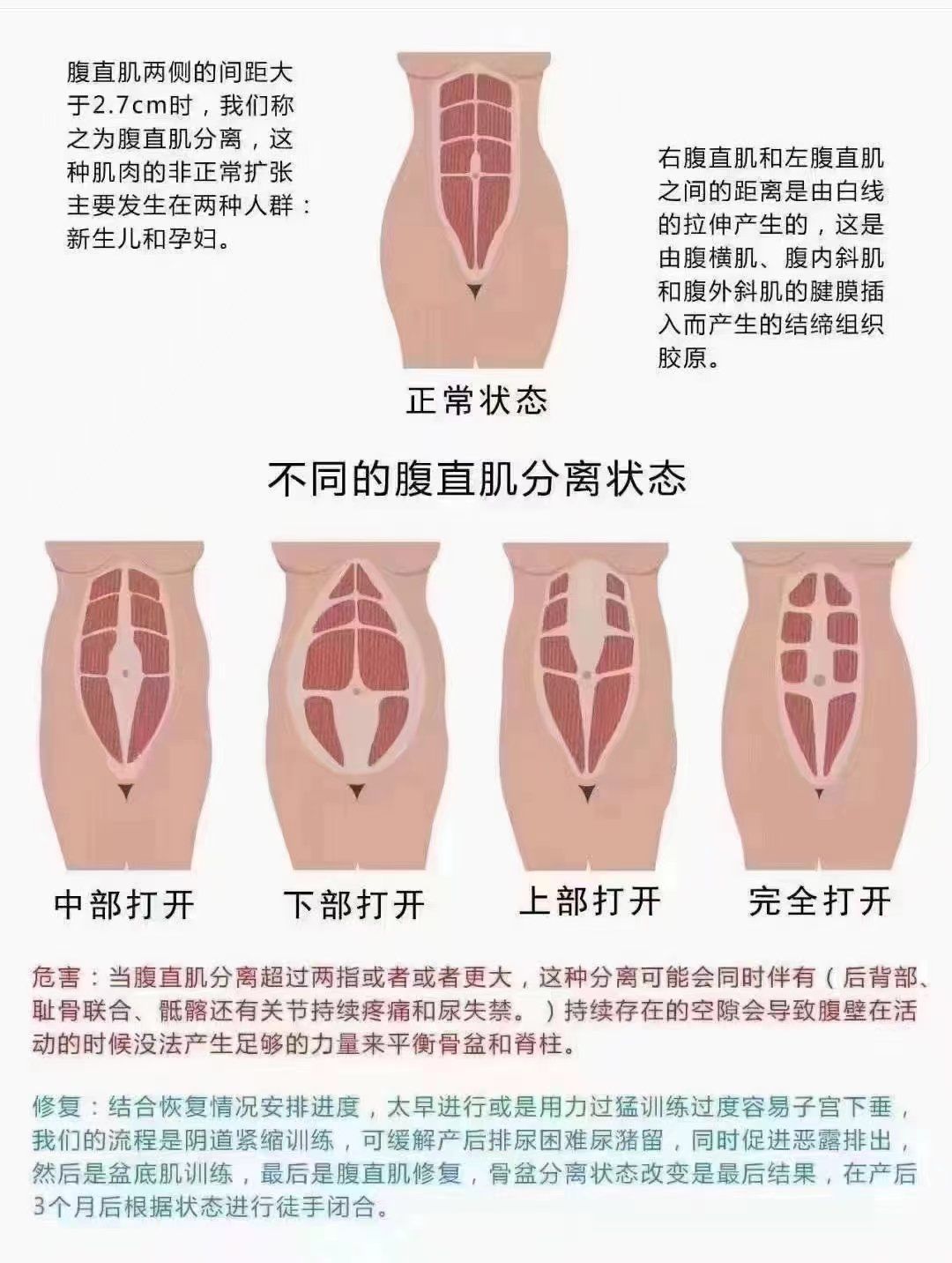 腹直肌