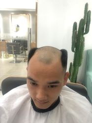 -发饰美男士增发补发假发定制店