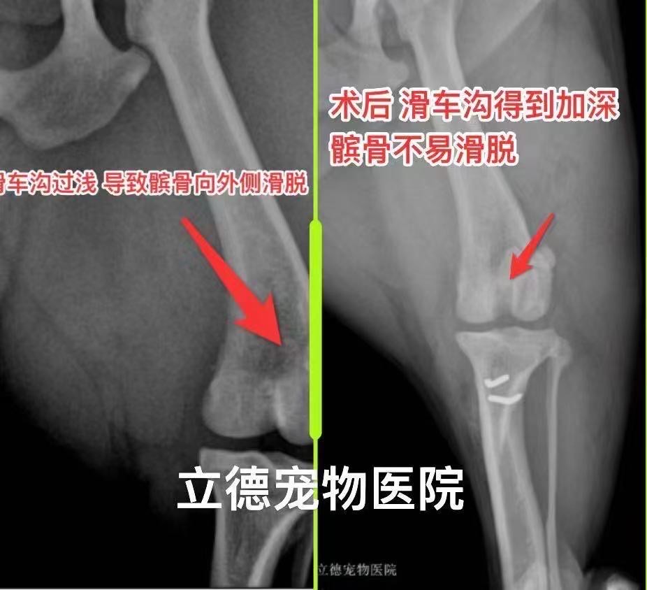 滑车重建术图片