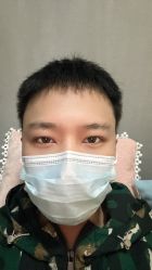 体验后-上海首尔丽格医疗美容医院