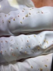-蕾特恩专业祛痘·皮肤管理