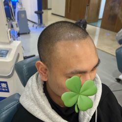 -大麦微针植发全国连锁