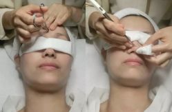 -苗方清颜痘肌研究所