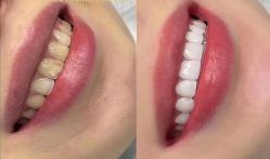 -美朵纹绣美牙纹眉工作室