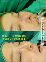 -北京米扬丽格医疗美容·联合丽格鼻整形中心
