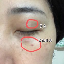 -贵阳美莱医疗美容整形医院