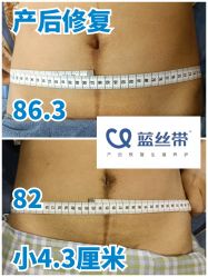 -蓝丝带产后恢复中心(都江堰店)