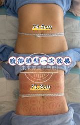 -未来美·减肥塑型瘦身纤体中心