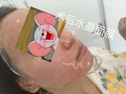 -慕颜医疗美容·皮肤微整 抗衰
