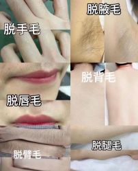 点击看大图 -玫莉蔻皮肤管理中心
