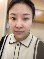 体验前-北京爱育华医院-医疗美容科