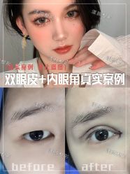 -上海漾颜医疗美容
