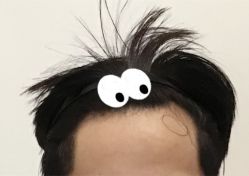 -大麦微针植发全国连锁