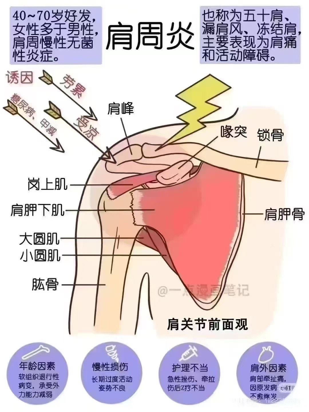 [爱心]分享一下什么是肩周炎 \\n1