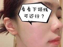 -FACE·日本小颜美容整骨(福田店)