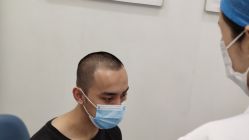 -大麦微针植发全国连锁