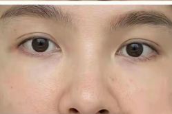 体验后-医颜医疗美容门诊部