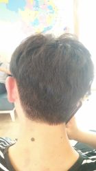 -大麦微针植发丨全国连锁