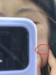 -成都军建医院·疤痕诊疗中心