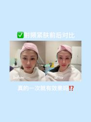 体验前-上海漾颜医疗美容