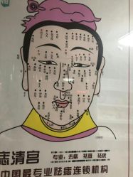 -痣清宫祛斑祛痣连锁店