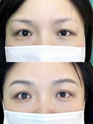 点击看大图 -杨益美学·野生眉半永久纹眉发际线