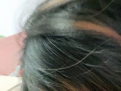 -爱美丽科技美肤中心