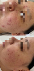 -康美贞·痘肌养护管理中心