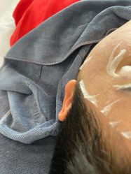 -瑶芳清颜草本祛痘