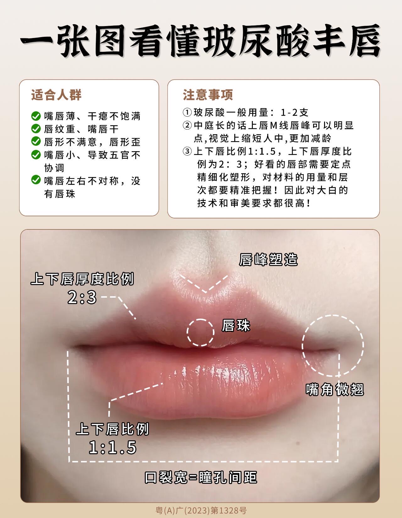 玻尿酸丰唇注射方法图片