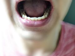 -Dr.Z dental仁康种植矫正中心