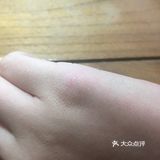 涂的地方凉凉的很舒服 轻度烫伤应该都很适合