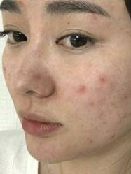 -SKINIST丽铂医疗美容