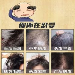 -诗碧曼养发